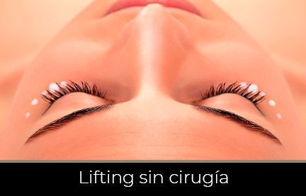 lifting-sin-cirugia